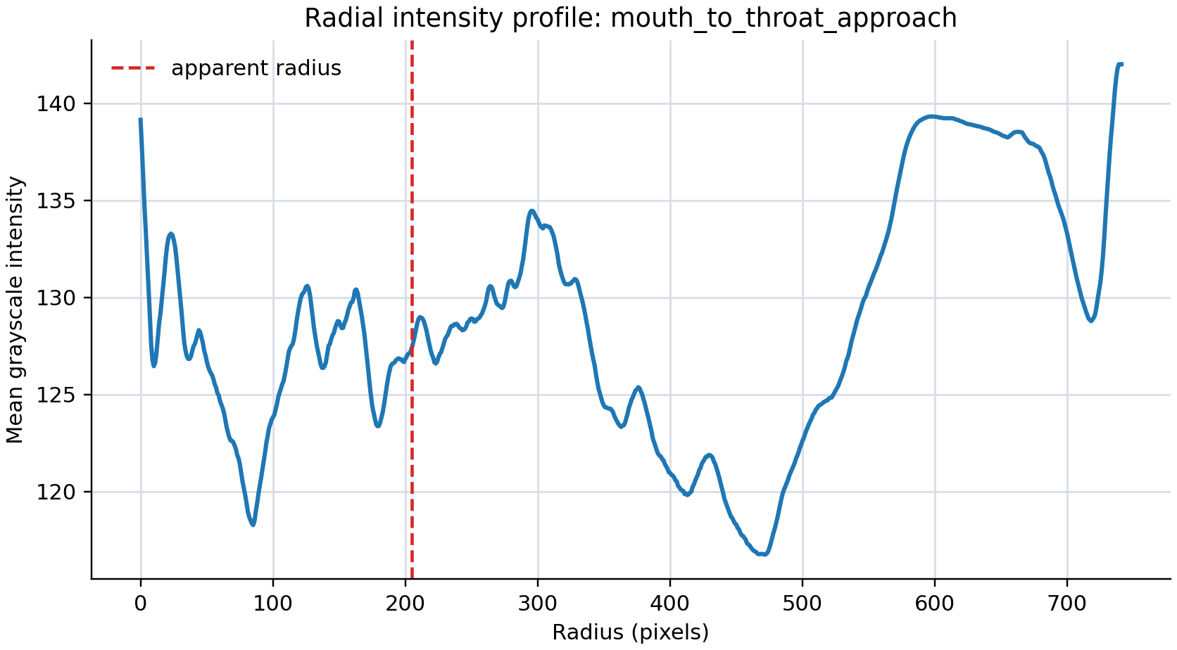 Mouth-to-throat approach radial profile